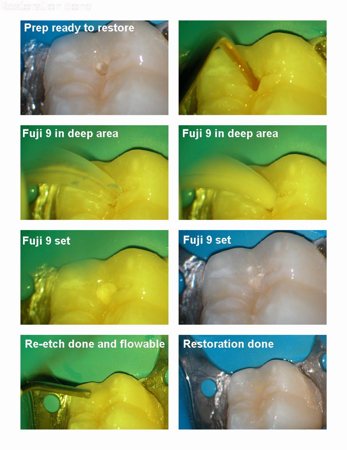 Pg 3 microdentistrybigger.jpg